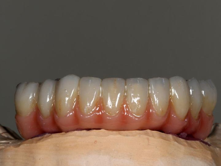 Caso real de estética final 4