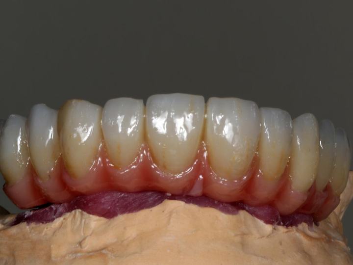 Caso real de estética final 5